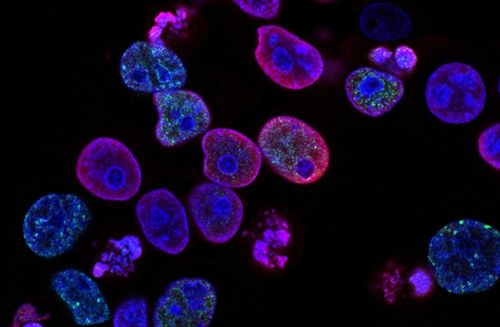 瑞士生物科技公司invasight利用突破性的細(xì)胞間蛋白靶點(diǎn)發(fā)現(xiàn)平臺,開發(fā)蛋白質(zhì) 蛋白質(zhì)相互作用抑制劑,靶向治療侵襲性癌癥 瑞士創(chuàng)新100強(qiáng)